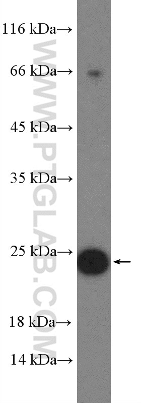 Western Blot (WB) analysis of MCF-7 cells using RAB11A/B Polyclonal antibody (15903-1-AP)