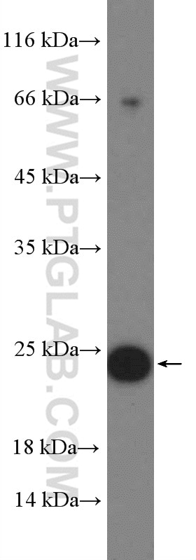 WB analysis of MCF-7 using 15903-1-AP