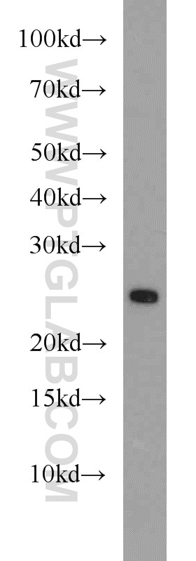 Western Blot (WB) analysis of mouse spleen tissue using RAB11A/B Polyclonal antibody (15903-1-AP)