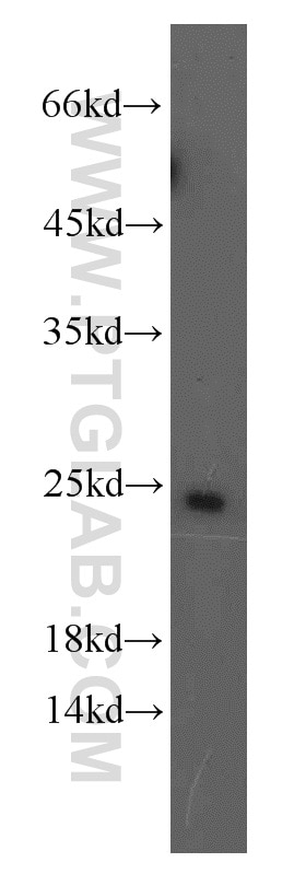 Western Blot (WB) analysis of Jurkat cells using RAB11A/B Polyclonal antibody (15903-1-AP)