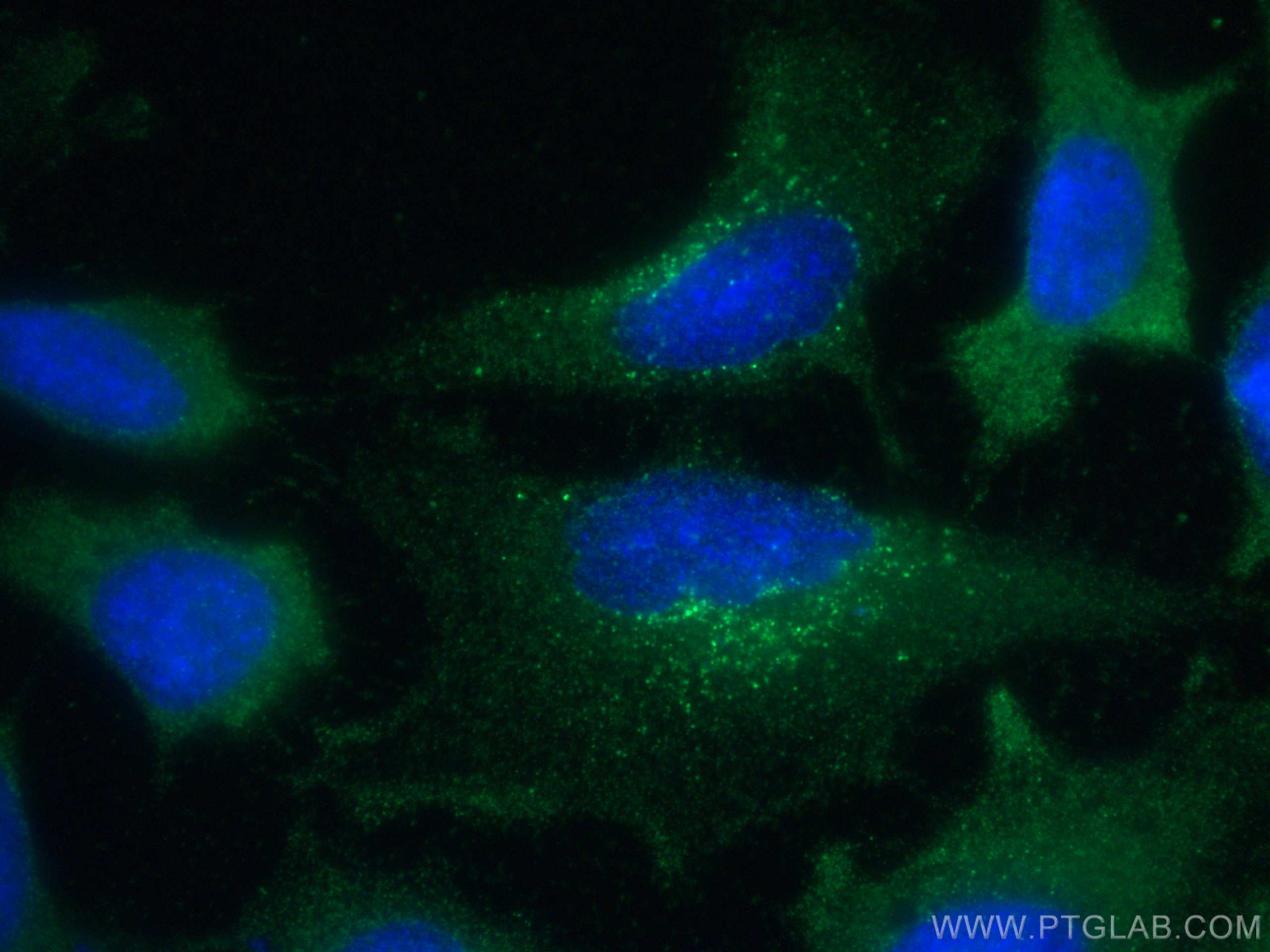 Immunofluorescence (IF) / fluorescent staining of HeLa cells using RAB11A Monoclonal antibody (67902-1-Ig)