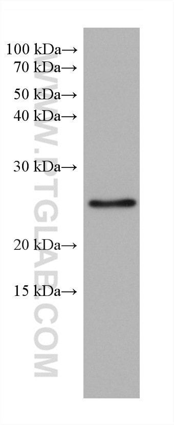 WB analysis of rat brain using 67902-1-Ig