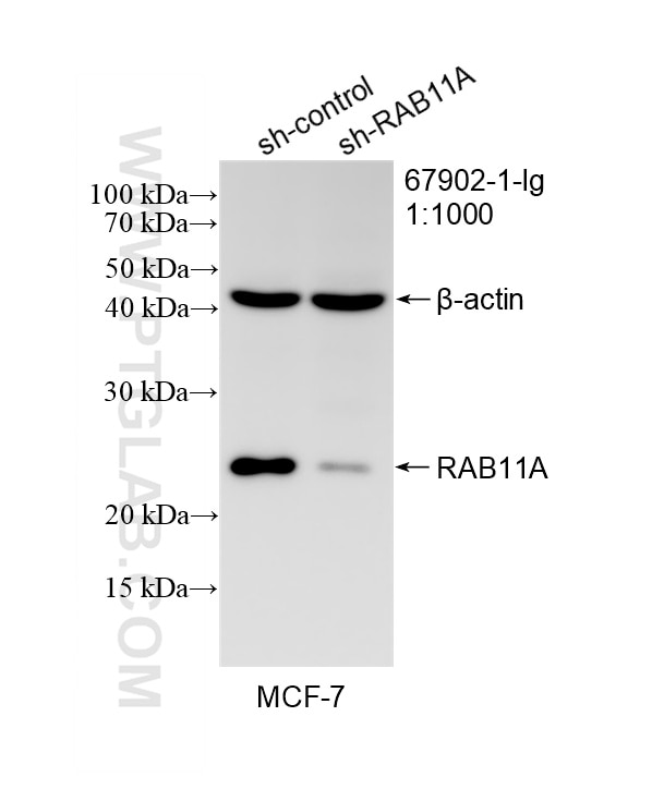 WB result of RAB11A antibody (67902-1-Ig; 1:1000; incubated at room temperature for 1.5 hours) with sh-Control and sh-RAB11A transfected MCF-7 cells. Western Blot (WB) analysis of MCF-7 cells using RAB11A Monoclonal antibody (67902-1-Ig)