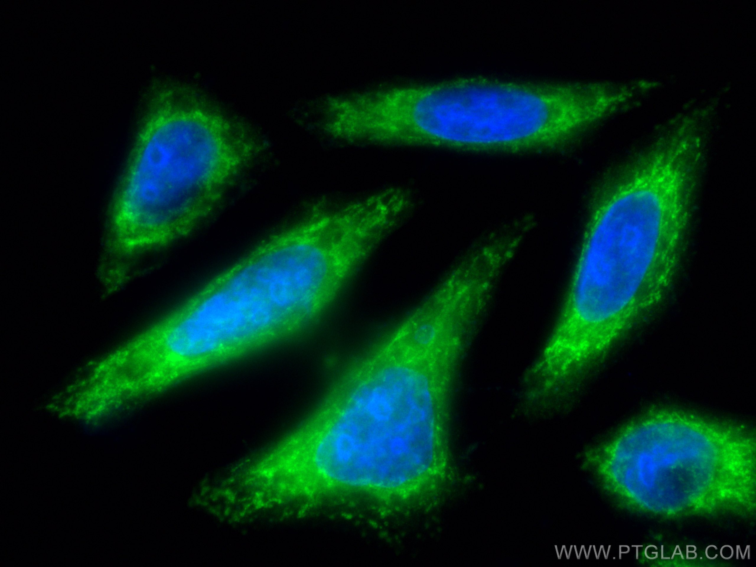 Immunofluorescence (IF) / fluorescent staining of HepG2 cells using CoraLite® Plus 488-conjugated RAB11A/B Polyclonal  (CL488-15903)