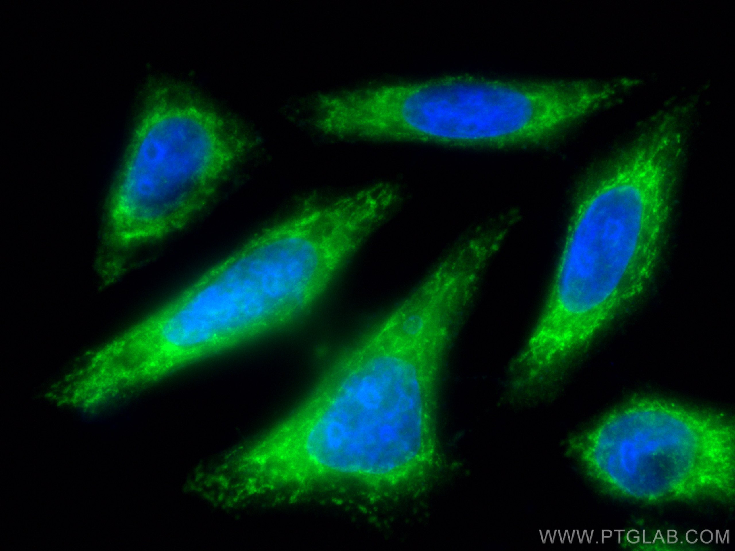 IF Staining of HepG2 using CL488-15903