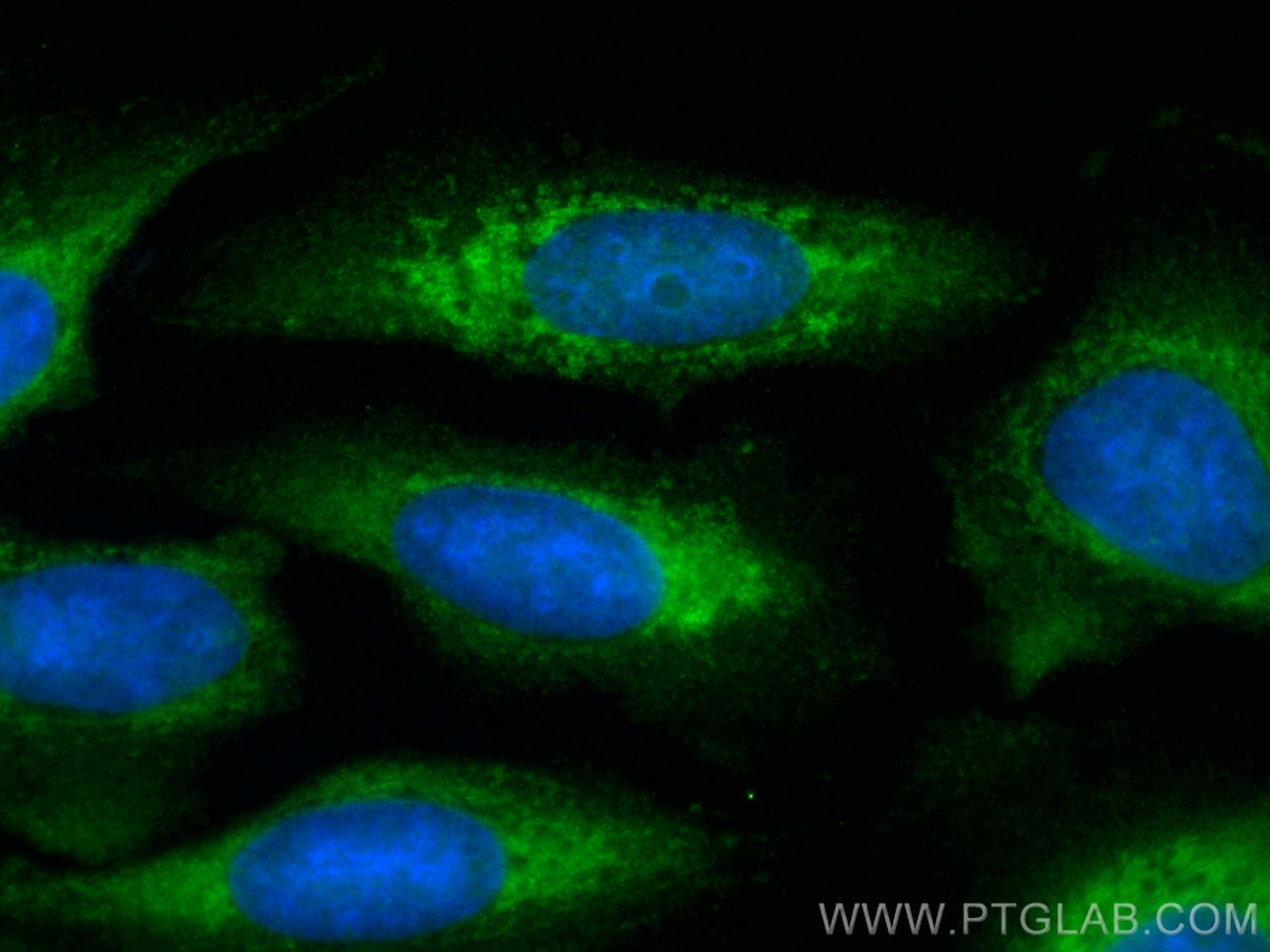 Immunofluorescence (IF) / fluorescent staining of U2OS cells using CoraLite® Plus 488-conjugated RAB11A/B Polyclonal  (CL488-15903)
