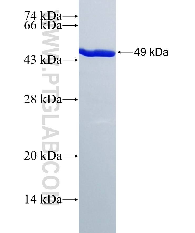 RAB11A fusion protein Ag8742 SDS-PAGE
