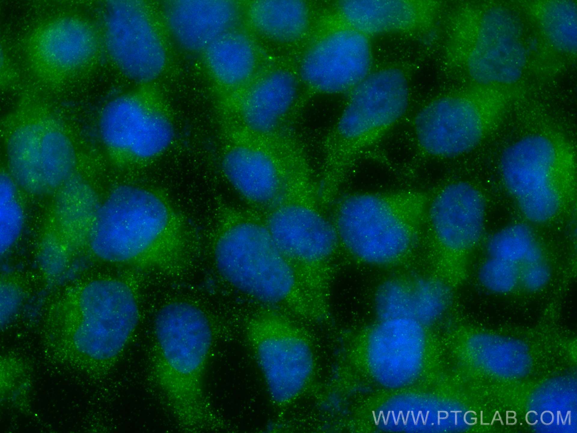 Immunofluorescence (IF) / fluorescent staining of HEK-293 cells using RAB11A-Specific Polyclonal antibody (20229-1-AP)