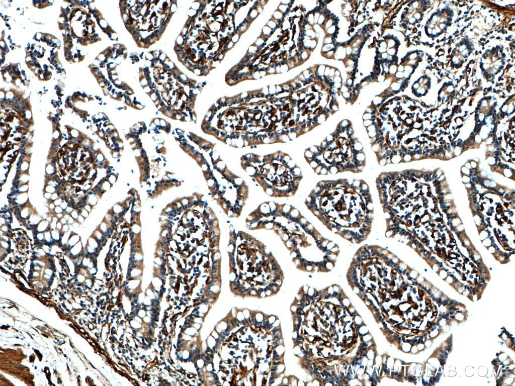 IHC staining of human small intestine using 20229-1-AP