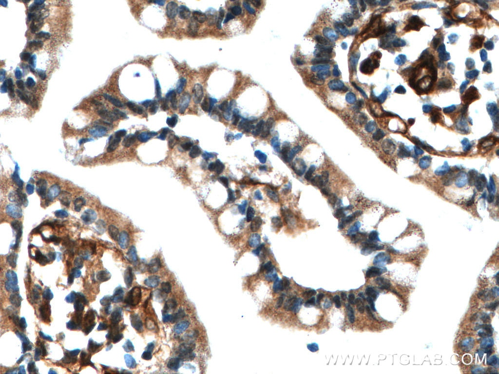 Immunohistochemistry (IHC) staining of human small intestine tissue using RAB11A-Specific Polyclonal antibody (20229-1-AP)