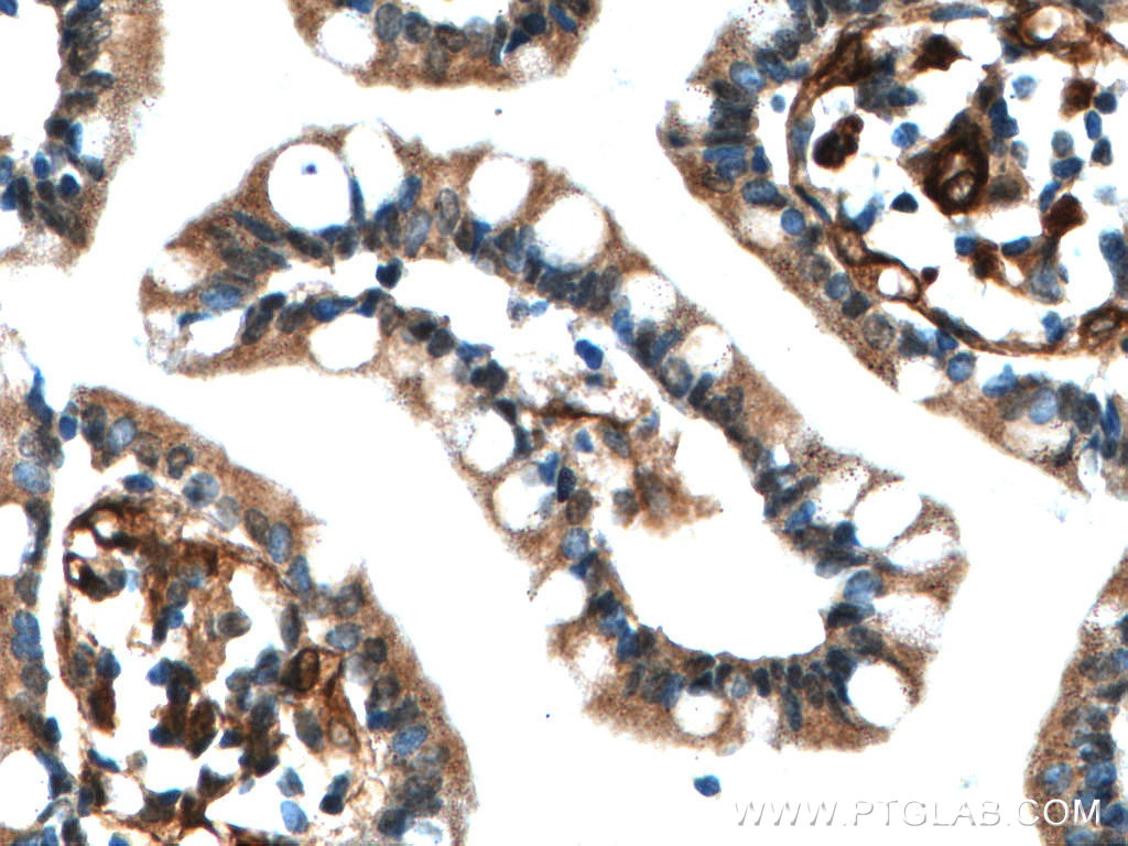 IHC staining of human small intestine using 20229-1-AP