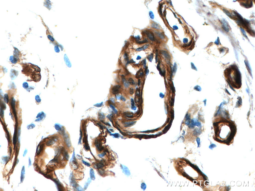 Immunohistochemistry (IHC) staining of human small intestine tissue using RAB11A-Specific Polyclonal antibody (20229-1-AP)