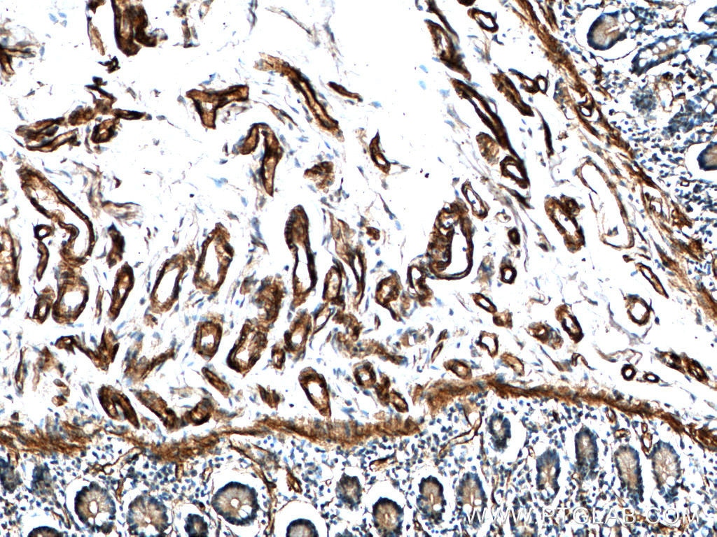 Immunohistochemistry (IHC) staining of human small intestine tissue using RAB11A-Specific Polyclonal antibody (20229-1-AP)