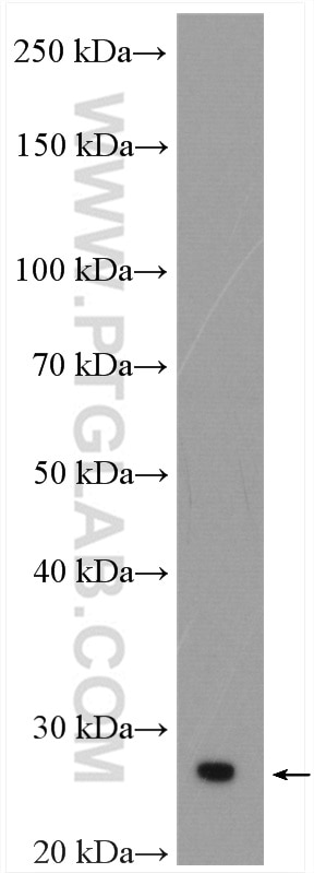 Western Blot (WB) analysis of rat brain tissue using RAB11A-Specific Polyclonal antibody (20229-1-AP)