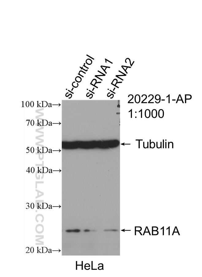 Western Blot (WB) analysis of HeLa cells using RAB11A-Specific Polyclonal antibody (20229-1-AP)