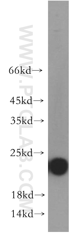 Western Blot (WB) analysis of human brain tissue using RAB11A-Specific Polyclonal antibody (20229-1-AP)