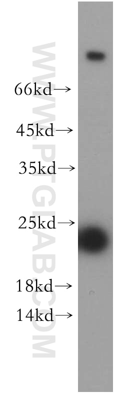 Western Blot (WB) analysis of mouse colon tissue using RAB11A-Specific Polyclonal antibody (20229-1-AP)