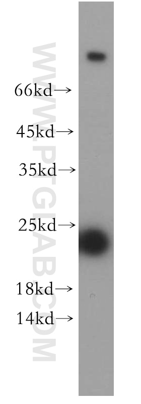 WB analysis of mouse colon using 20229-1-AP