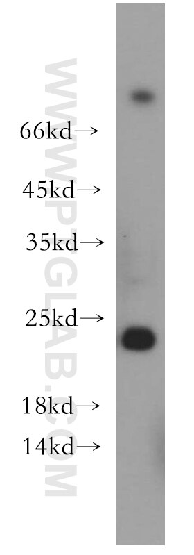 Western Blot (WB) analysis of SH-SY5Y cells using RAB11A-Specific Polyclonal antibody (20229-1-AP)