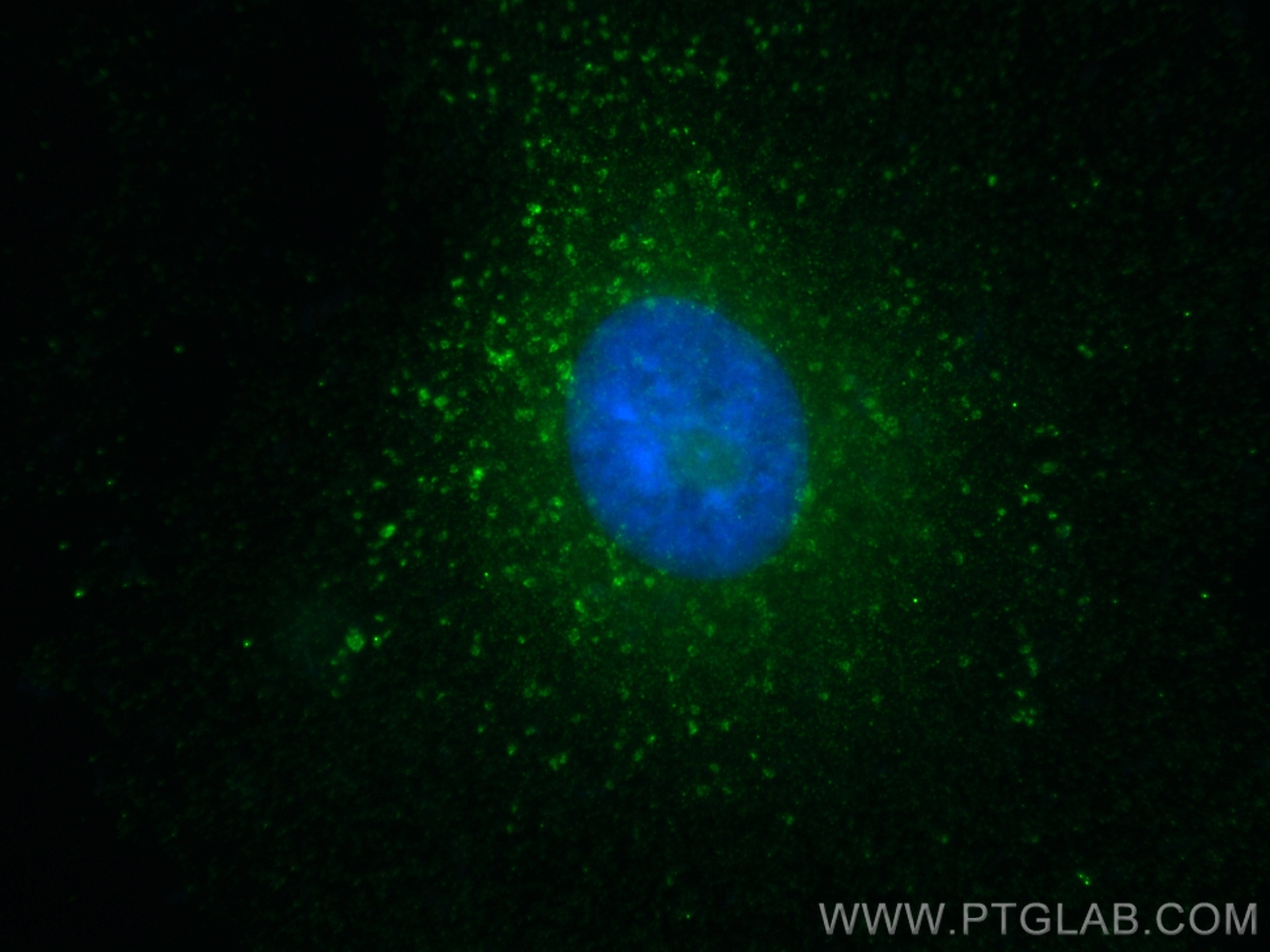 Immunofluorescence (IF) / fluorescent staining of A549 cells using RAB11B Polyclonal antibody (28498-1-AP)