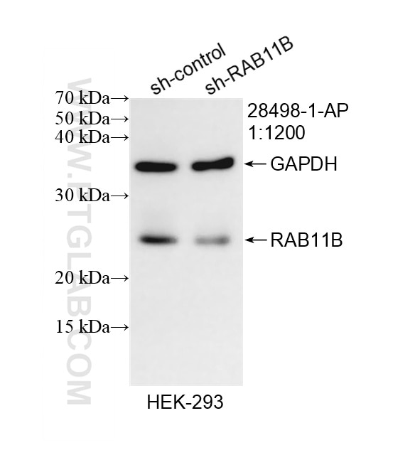 Western Blot (WB) analysis of HEK-293 cells using RAB11B Polyclonal antibody (28498-1-AP)