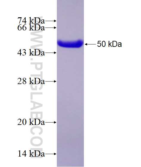 RAB11B fusion protein Ag25429 SDS-PAGE