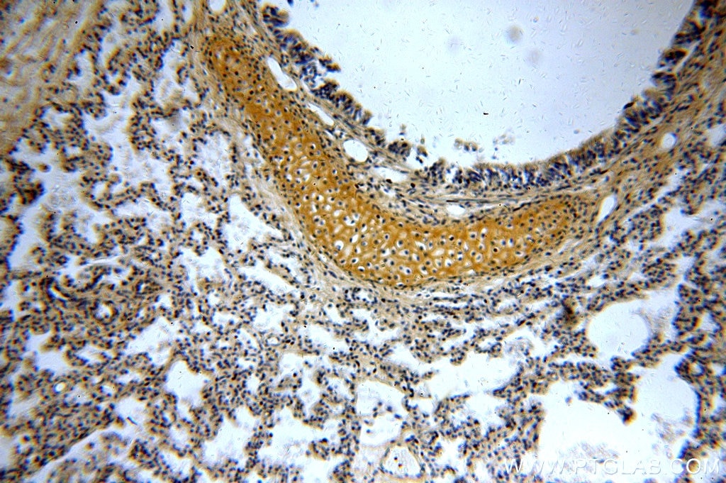 Immunohistochemistry (IHC) staining of human lung tissue using RAB11B-Specific Polyclonal antibody (19742-1-AP)