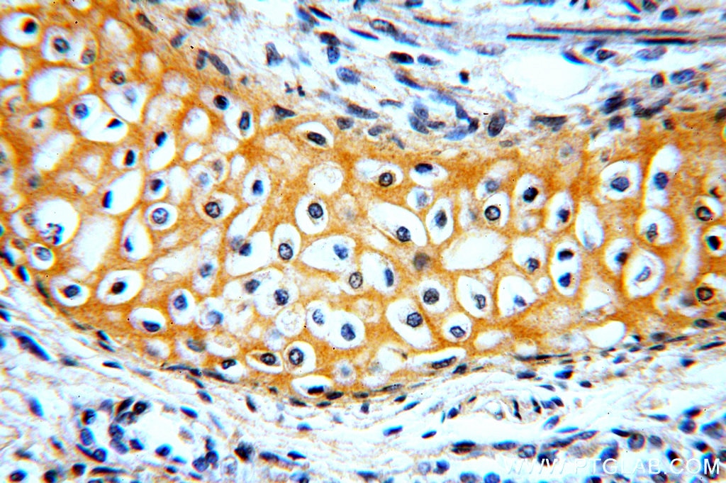 IHC staining of human lung using 19742-1-AP