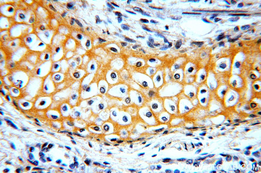 Immunohistochemistry (IHC) staining of human lung tissue using RAB11B-Specific Polyclonal antibody (19742-1-AP)