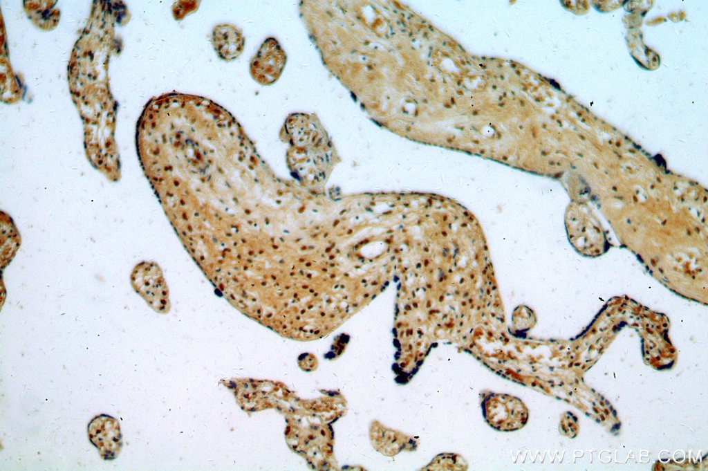 Immunohistochemistry (IHC) staining of human placenta tissue using RAB11B-Specific Polyclonal antibody (19742-1-AP)