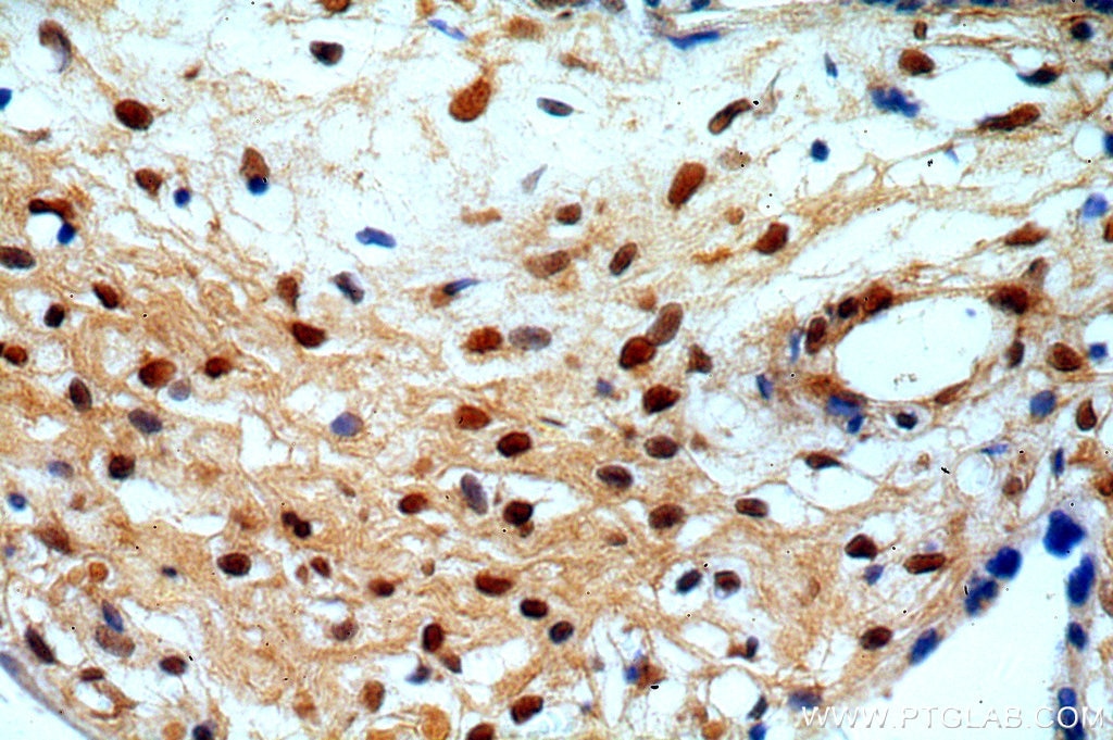 Immunohistochemistry (IHC) staining of human placenta tissue using RAB11B-Specific Polyclonal antibody (19742-1-AP)