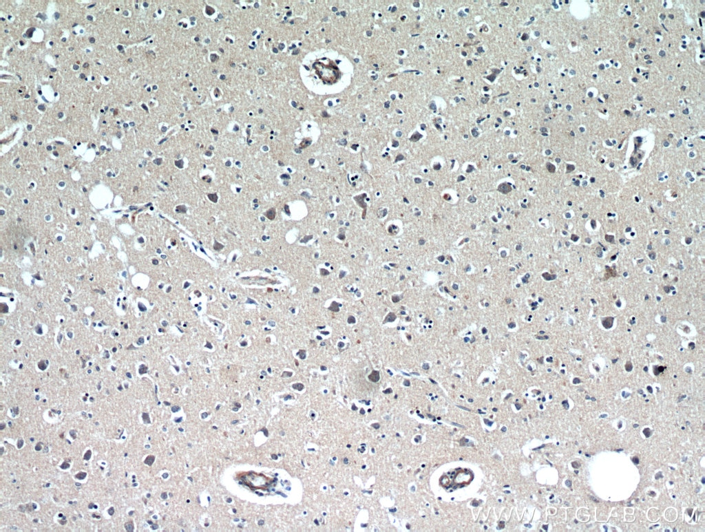 Immunohistochemistry (IHC) staining of human brain tissue using RAB11B-Specific Polyclonal antibody (19742-1-AP)