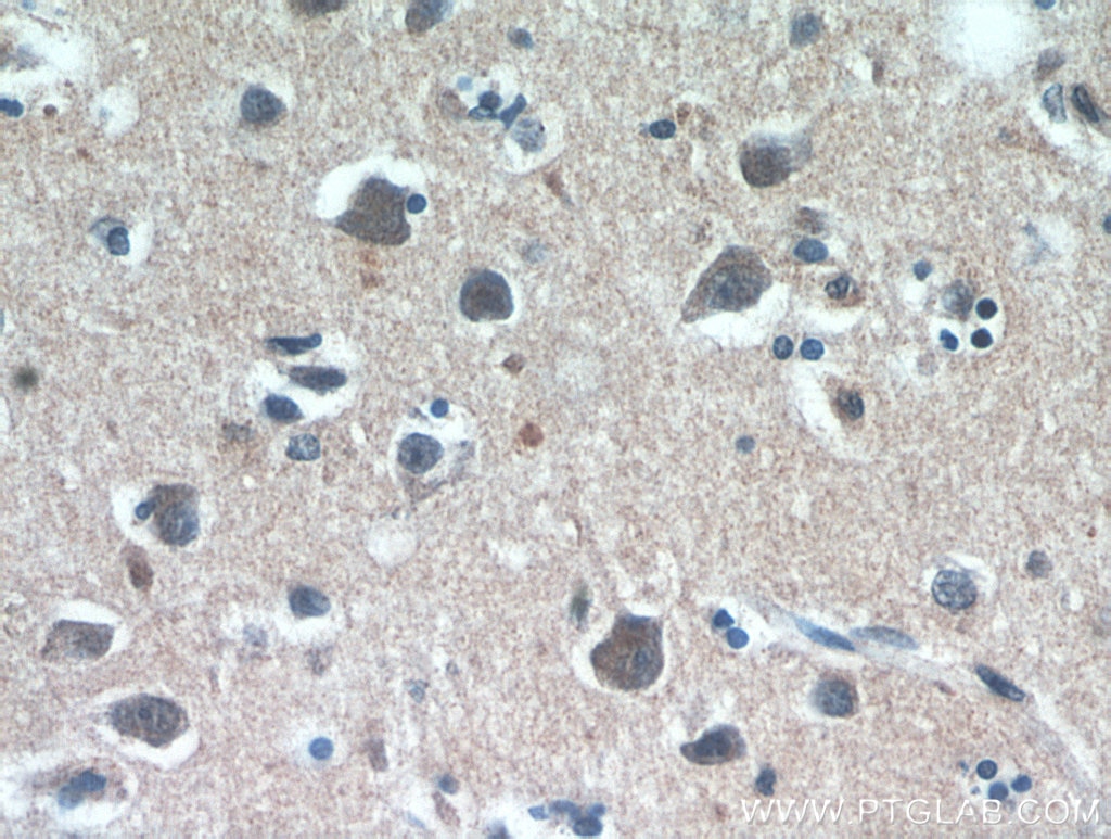 Immunohistochemistry (IHC) staining of human brain tissue using RAB11B-Specific Polyclonal antibody (19742-1-AP)