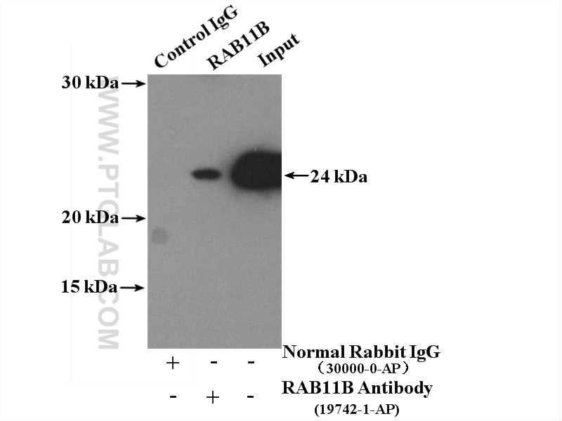 Immunoprecipitation (IP) experiment of mouse brain tissue using RAB11B-Specific Polyclonal antibody (19742-1-AP)