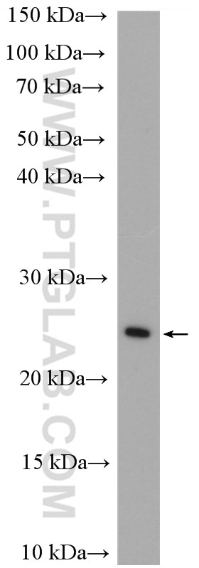 WB analysis of HEK-293 using 19742-1-AP