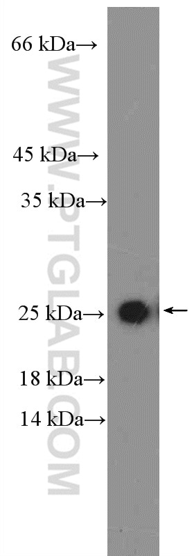 Western Blot (WB) analysis of fetal human brain tissue using RAB11B-Specific Polyclonal antibody (19742-1-AP)