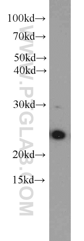 Western Blot (WB) analysis of human testis tissue using RAB11B-Specific Polyclonal antibody (19742-1-AP)