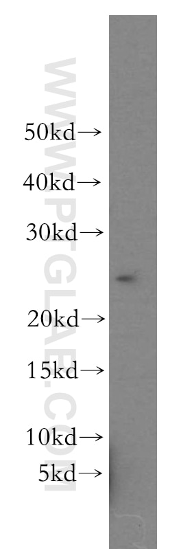 Western Blot (WB) analysis of HeLa cells using RAB11B-Specific Polyclonal antibody (19742-1-AP)