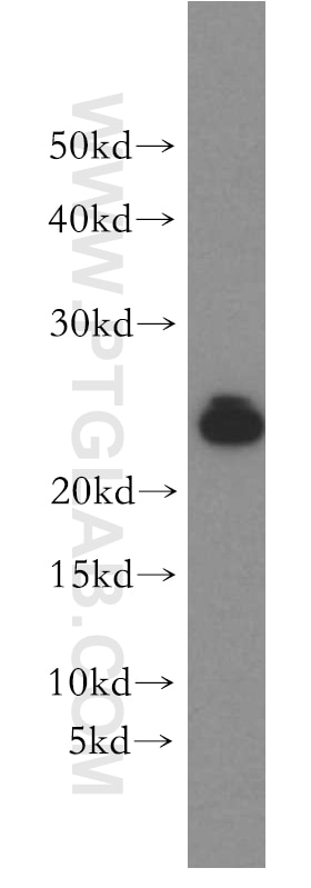 Western Blot (WB) analysis of human brain tissue using RAB11B-Specific Polyclonal antibody (19742-1-AP)