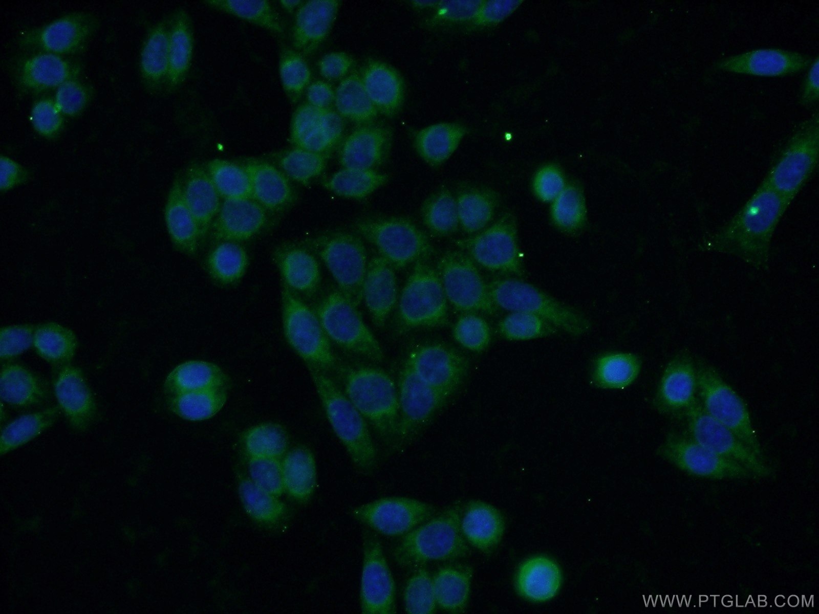 IF Staining of HeLa using 16778-1-AP