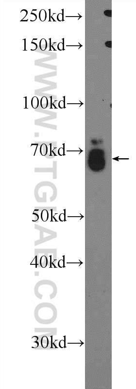 Western Blot (WB) analysis of SKOV-3 cells using RAB11FIP1 Polyclonal antibody (16778-1-AP)