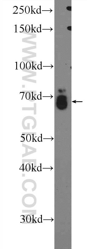 WB analysis of SKOV-3 using 16778-1-AP