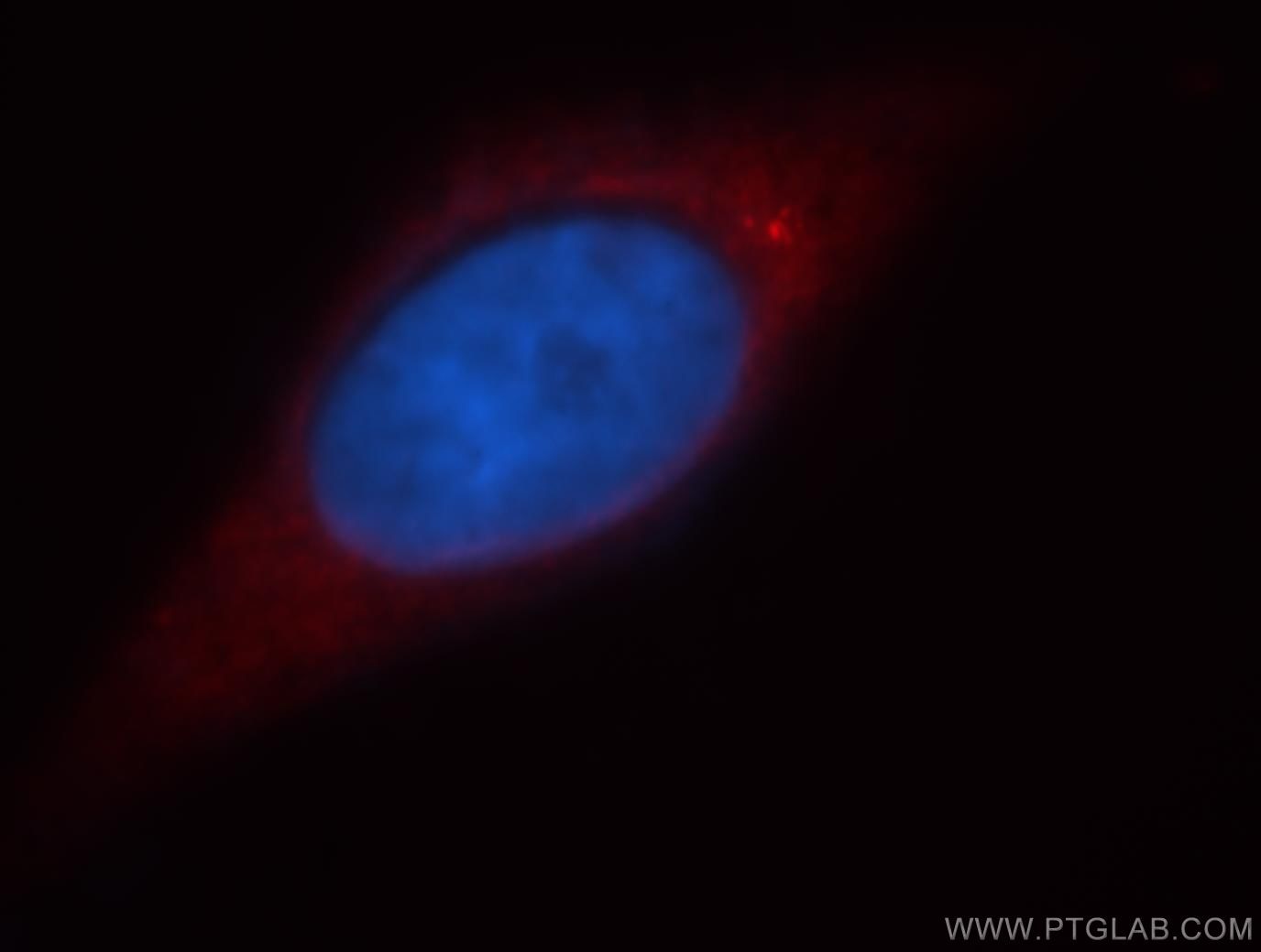 Immunofluorescence (IF) / fluorescent staining of HepG2 cells using RAB11FIP2 Polyclonal antibody (18136-1-AP)