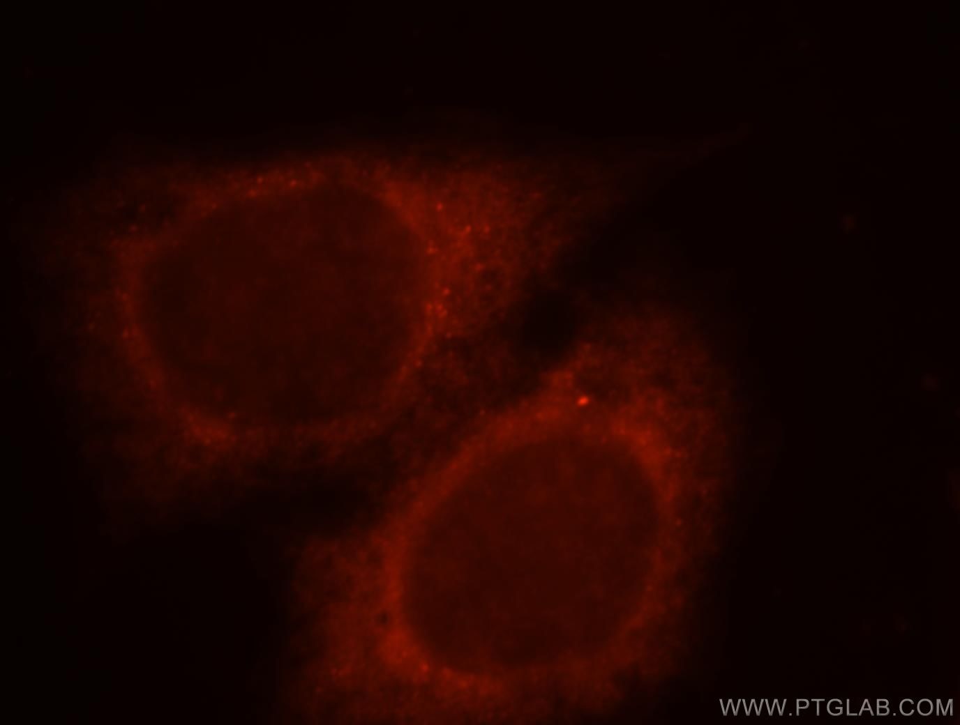 Immunofluorescence (IF) / fluorescent staining of HeLa cells using RAB11FIP2 Polyclonal antibody (18136-1-AP)