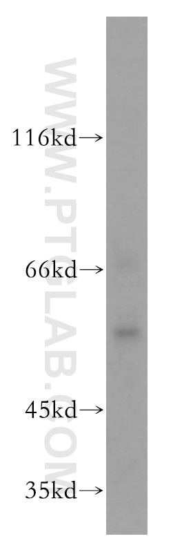 Western Blot (WB) analysis of mouse liver tissue using RAB11FIP2 Polyclonal antibody (18136-1-AP)