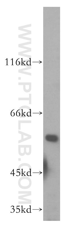 Western Blot (WB) analysis of HEK-293 cells using RAB11FIP2 Polyclonal antibody (18136-1-AP)