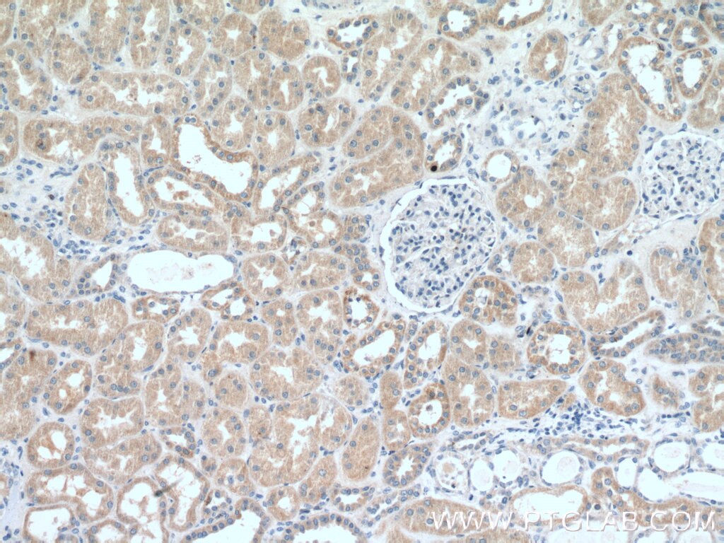Immunohistochemistry (IHC) staining of human kidney tissue using RAB11FIP3 Polyclonal antibody (25843-1-AP)