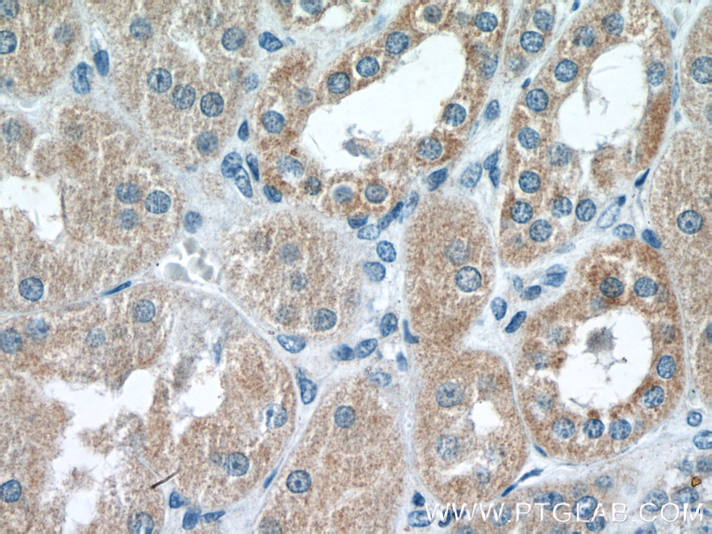 Immunohistochemistry (IHC) staining of human kidney tissue using RAB11FIP3 Polyclonal antibody (25843-1-AP)