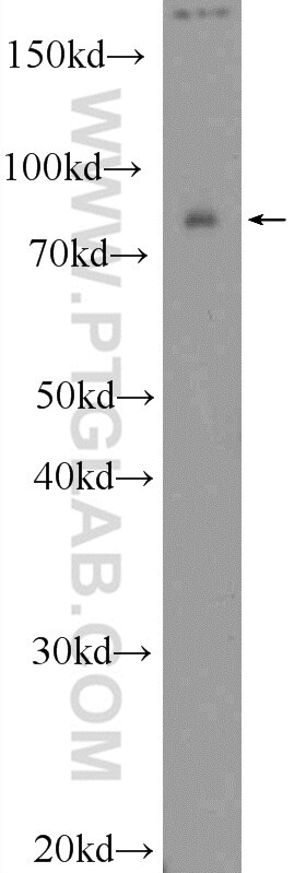 Western Blot (WB) analysis of mouse brain tissue using RAB11FIP3 Polyclonal antibody (25843-1-AP)