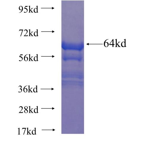 RAB11FIP3 fusion protein Ag22937 SDS-PAGE